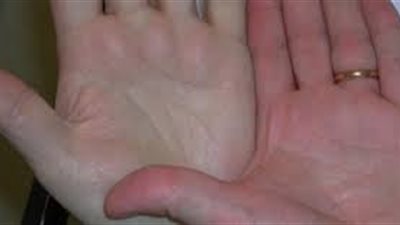 انطلاق حملة «من أجل صحة أفضل لأبنائنا» فى القليوبية.. اليوم