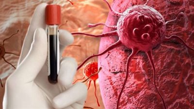 الصحة تحذر من 6 مستحضرات بالسوق لعلاج السرطان: مغشوشة ومهربة