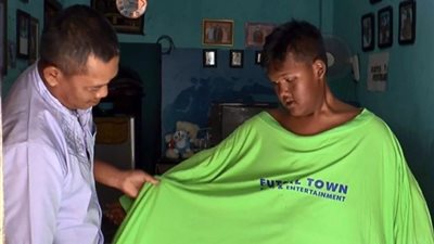 أسمن طفل في إندونيسيا يخسر نصف وزنه بعد تخليه عن السكر (فيديو)