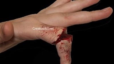 بالفيديو.. 2 مليون مشاهدة لخدعة الإصبع المكسور