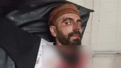 مجهولون يعتدون على مزارع في الشرقية