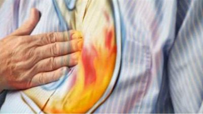 طرق طبيعية لعلاج حموضة المعدة