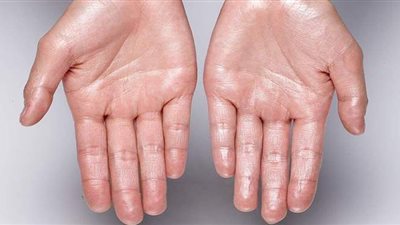 طبيبة روسية تقدم نصائح للتقليل من التعرق في الجو الحار