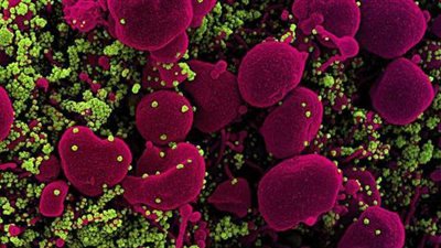 لامبدا.. ما هو متحور كورونا الجديد المقاوم للقاحات