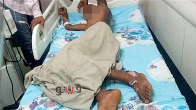 رش عليه بنزين وولع فيه.. شاب يشرع في قتل صديقه بطريقة بشعة بالغربية