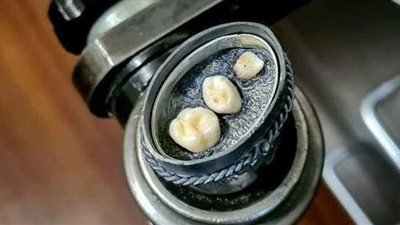 لتخليد ذكرى الراحلين.. فتاة تصمم جواهر من أسنان الموتى | صور