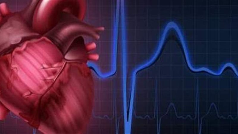 عدم انتظام ضربات