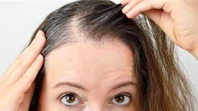 تعرف على أسباب ظهور الشعر الأبيض مبكرا