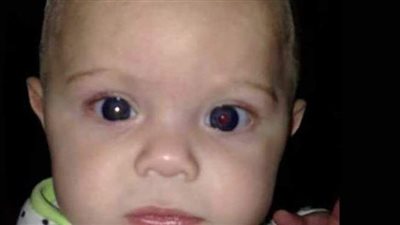 سيدة تكتشف إصابة ابنها بالسرطان من صورة هاتف