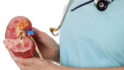 كل ما تودين معرفته عن التهاب المثانة.. الأسباب والأعراض وطرق العلاج