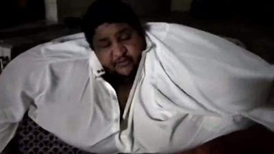 السعودية تبدأ رحلة تخسيس أسمن رجل في العالم