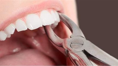 حادث مثير.. أمريكية تقتلع 13 سناً من مريضة بعد تخديرها