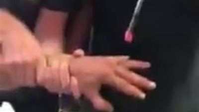 رجل يزيل وشم زواجه أمام الكاميرا بعد طلاقه (فيديو وصور)