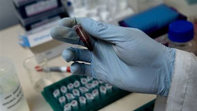 أستاذ أورام: نسب شفاء السرطان متفاوتة