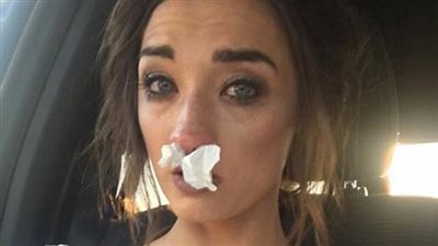 تسمم عروس بسبب باقة زهور حفل زفافها (صور)