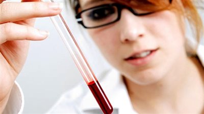 8 وصفات طبيعية تخلصك من الكوليسترول الضار