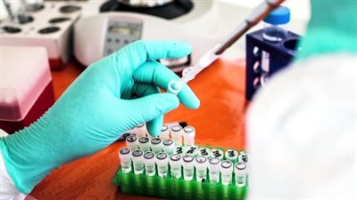 فرار 24 مريضا من مركز لعلاج الإيبولا بالكونغو