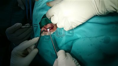 فريق طبي ينقذ رضيعة بعد إزالة ورم من فكها بمستشفي الغردقة العام (صور)