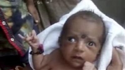 قرويون يعبدون طفلة ولدت بطرف زائد (صور)