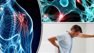 على نفقة الدولة.. تفاصيل علاج مرضى التصلب المتعدد