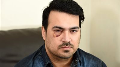 لقطات صادمة لفتاة تغرز حذاءها في عين سائق تاكسي (فيديو وصور)