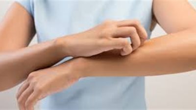 نصائح للتخلص من حساسية الجلد في المناخ البارد (صوت)