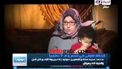 شاهد.. طفل مصري دون عينين وأنف