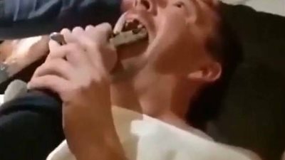 رجل يخلع ضرس صديقه على طريقة العصابات (فيديو وصور)