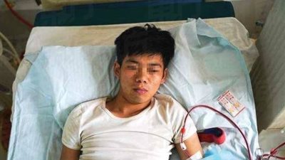 إصابة رجل بإعاقة دائمة بعد بيع كليته لشراء آيفون (فيديو)