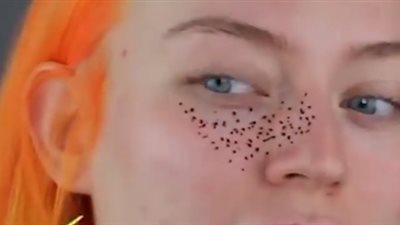 الحنة تشوه وجه امرأة حاولت استخدامها كنمش مؤقت (فيديو)