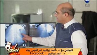 بالفيديو..الطعام غير الصحى يسبب السمنة المفرطة