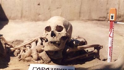 العثور على أقدم حالة إصابة بالسرطان في التاريخ