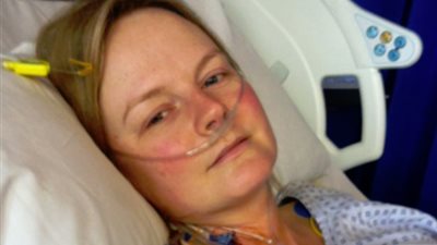 فتاة مصرية تواجه السرطان في النمسا وتتصدر صفحات الجرائد الألمانية