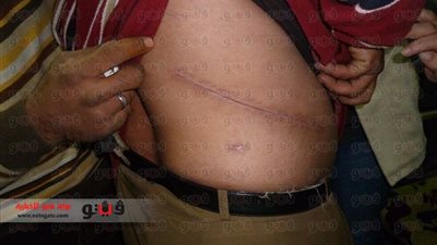 بالفيديو.. أحد ضحايا 