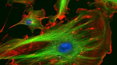 دراسة أمريكية تكشف أسباب مرض الإنسان.. عضو بالإنسان السبب الرئيسى في تدهور الخلايا المخية.. يؤدى إلى التهاب الشعب الهوائية والسكر وتصلب الشرايين.. يسبب العقم لدى الرجال