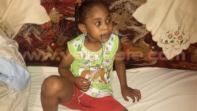 بالصور.. طفلة بأسوان تعيش بالقيود بسبب خطأ في عملية الختان