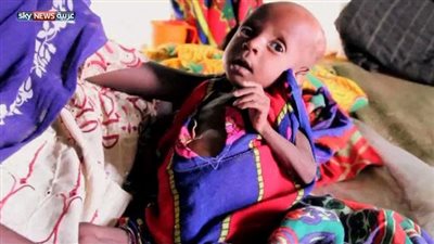 مصر تفقد أكثر من 20 مليار جنيه بسبب إصابة الإطفال بنقص التغذية