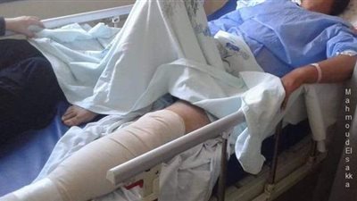 وزير القوى العاملة يتابع حادث إصابة عامل بحقل ظهر