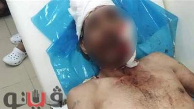 أصابوه في العضو الذكري.. قصة اعتداء أبناء سيدة على زوج أمهم بالإسماعيلية | شاهد