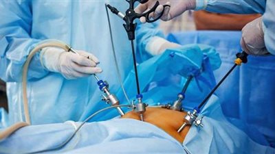 استشاري جراحة: التكميم الدقيق هدفه إخفاء الجروح وتقليل المضاعفات