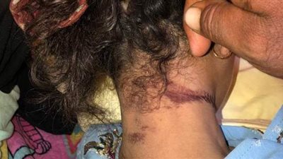 مصرع فتاة بسبب ماكينة ري فى الغربية