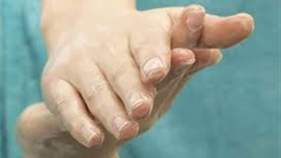 8 خطوات لحماية يديك من تشققات والتهابات الشتاء