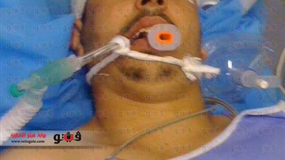 ننشر صورة المواطن المصري بعد نجاته من الاغتيال في ليبيا