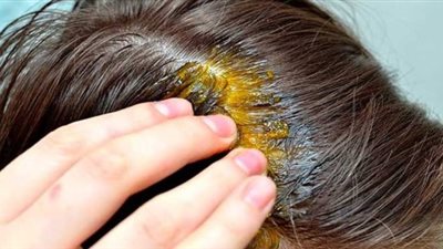 هاني الناظر يحذر من 4 كريمات فرد للشعر (فيديو)