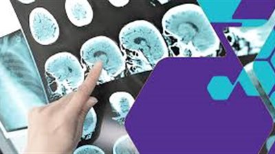 العلاج المناعي للسرطان يطيح بالكيماوي خلال عامين.. 113 ألف مصاب بالسرطان في مصر.. «متعافية من المرض»: ليس له آثار جانبية وشعري عاد لطبيعته.. ناظم شمس: نقلة جديدة ويركز على الورم مباشرة