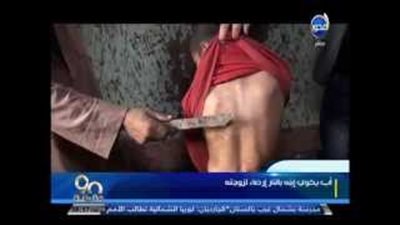 بالفيديو.. أب يعذب ابنه كيا بالنار إرضاء لزوجته