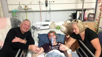 مرض غريب يصيب عين فتاة بكدمات غريبة (صور)