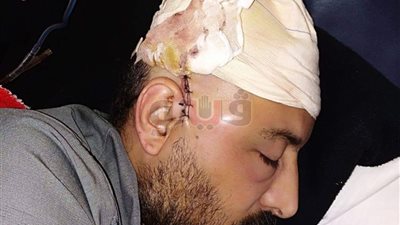 اصابة 3 أشخاص في مشاجرة لتجدد خلافات بين عائلتين بشبرا الخيمة (صور)