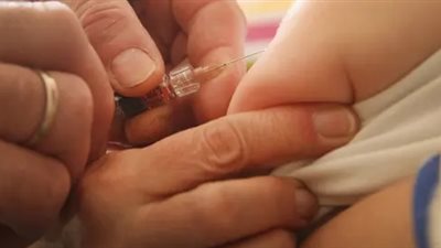 الحصبة تضرب نيوزيلندا وتصيب 22 شخصا بسبب نقص اللقاح