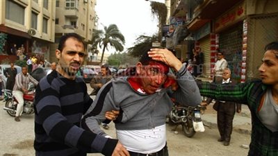 الصحة: خروج 372 مصابًا في اشتباكات أمس من المستشفيات